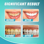 Load image into Gallery viewer, Intensive Stain Removal Whitening Toothpaste
